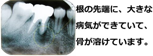 初診時Ｈ１７・10・6デンタル